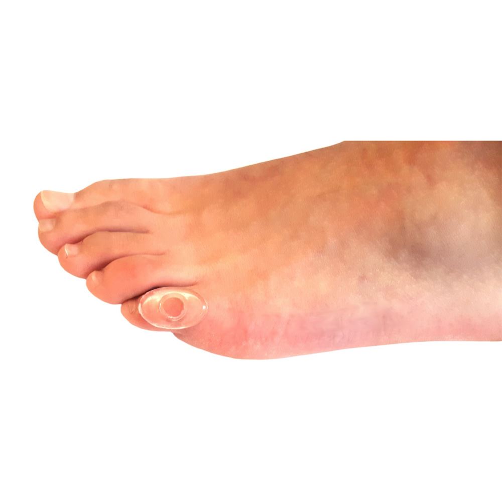 PhysiPod Gel Corn Pads – Targeted Cushioning for Toe Corns & Pressure Relief